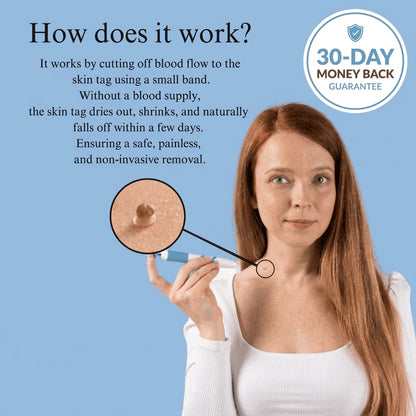 SUVORA™- Painless Skin Tag Removal Kit