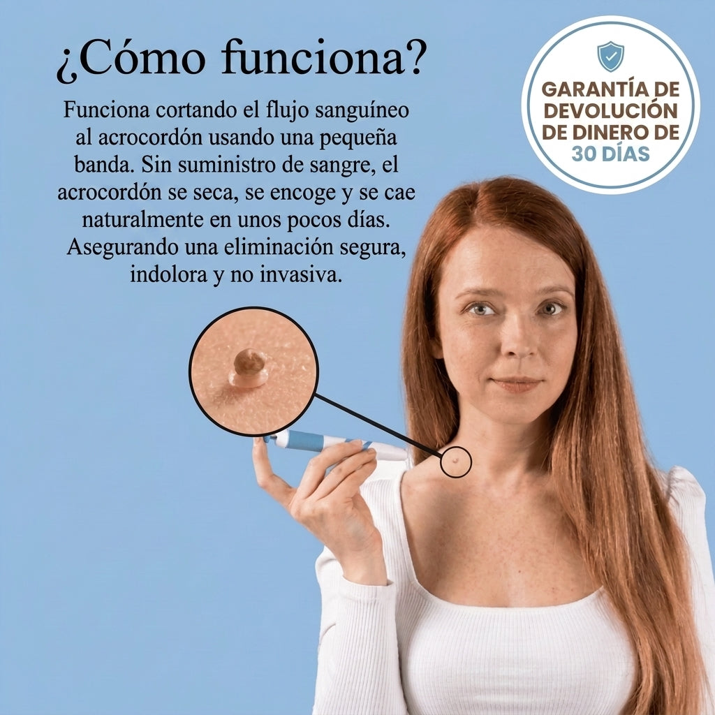 SUVORA™-Kit Indoloro para Verrugas